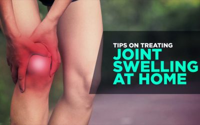 Tips on Treating Joint Swelling at Home