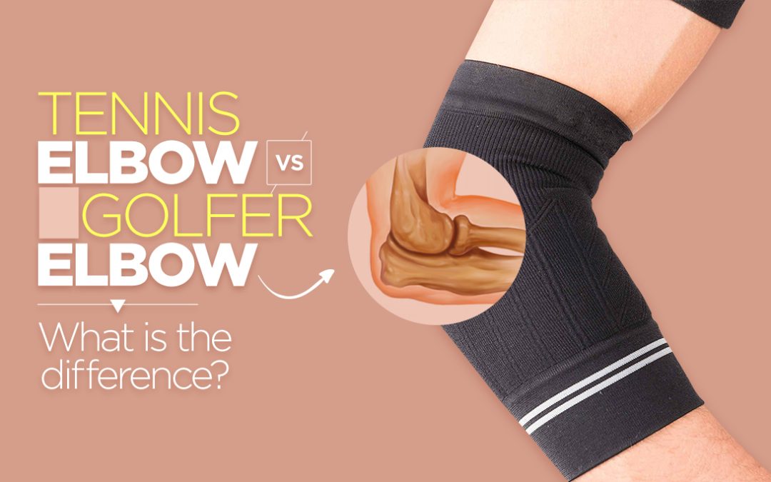 What Can I Do About Tennis and Golfer’s Elbow Pain?