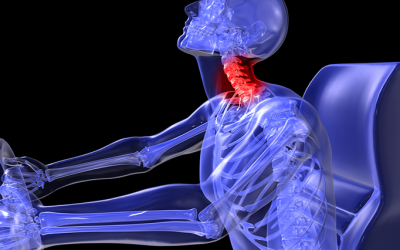 Immediate Chiropractic Treatment for a Car Accident Whiplash Injury