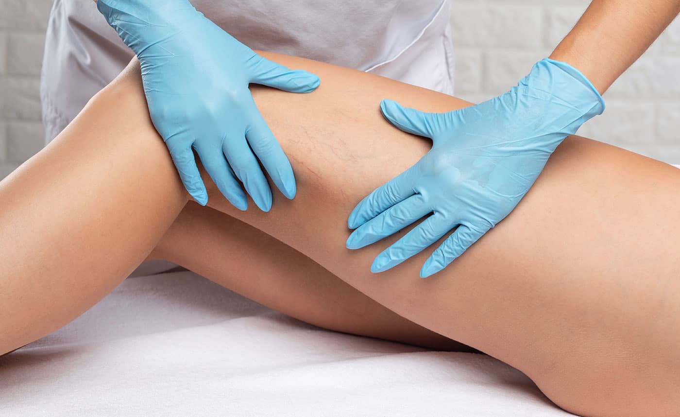 VEIN THERAPY SM