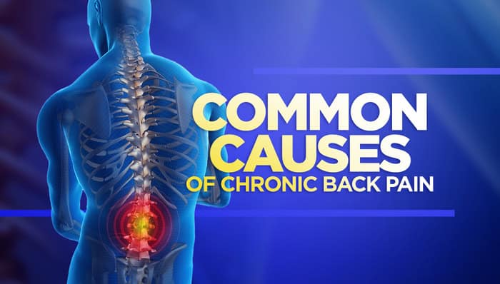 common-causes-of-chronic-back-pain.jpg