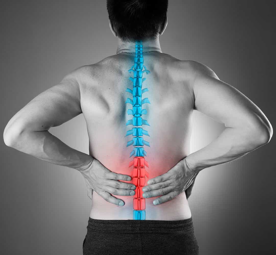 LOWER BACK PAIN 3